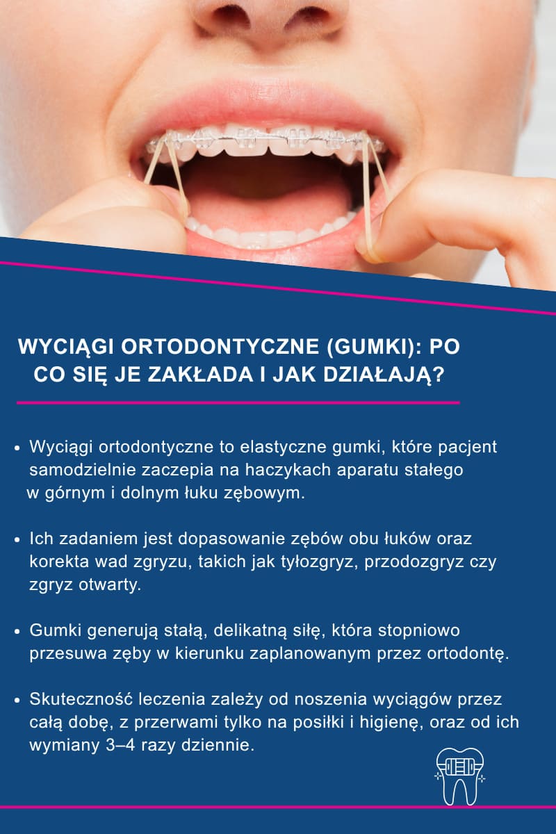 Wyciągi ortodontyczne (gumki): po co się je zakłada i jak działają?